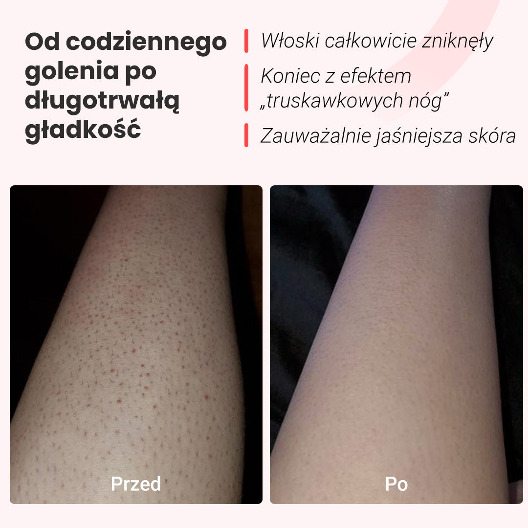 Depilator Hilda IPL