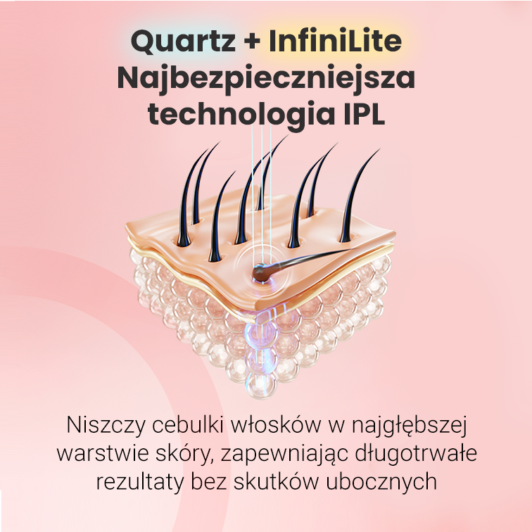 Depilator Hilda IPL
